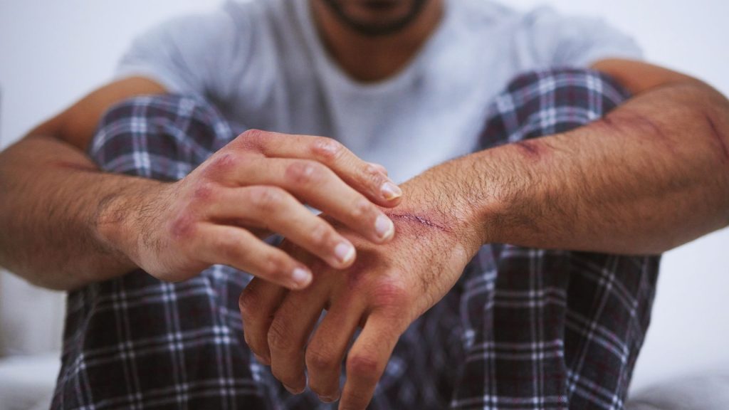 person seeks harm reduction strategy for opioid addiction
